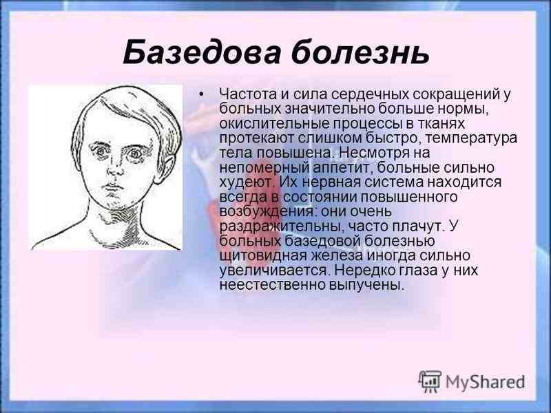 базедова болезнь что это такое