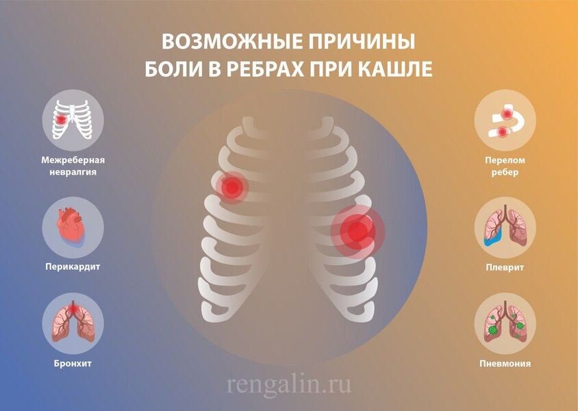 болит ребро с правой стороны при нажатии