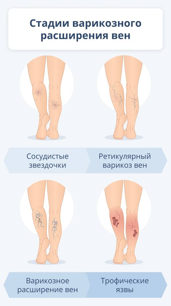 боль в ноге ниже колена