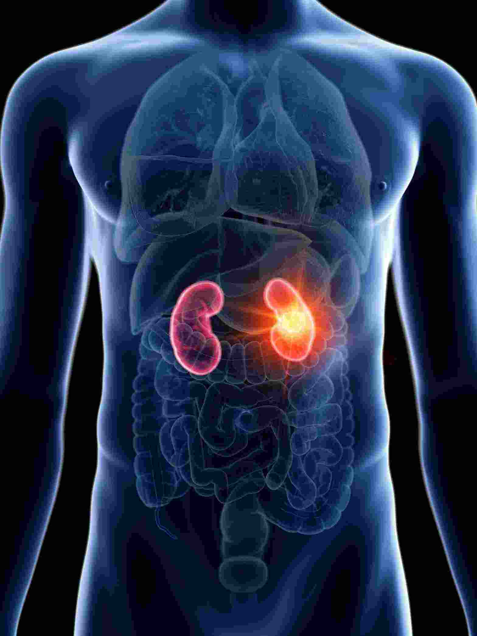 боль в почках симптомы у женщин