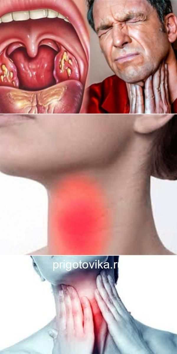 как быстро избавиться от боли в горле