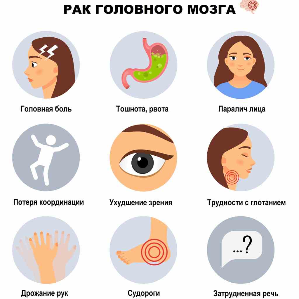 как понять что у тебя опухоль мозга