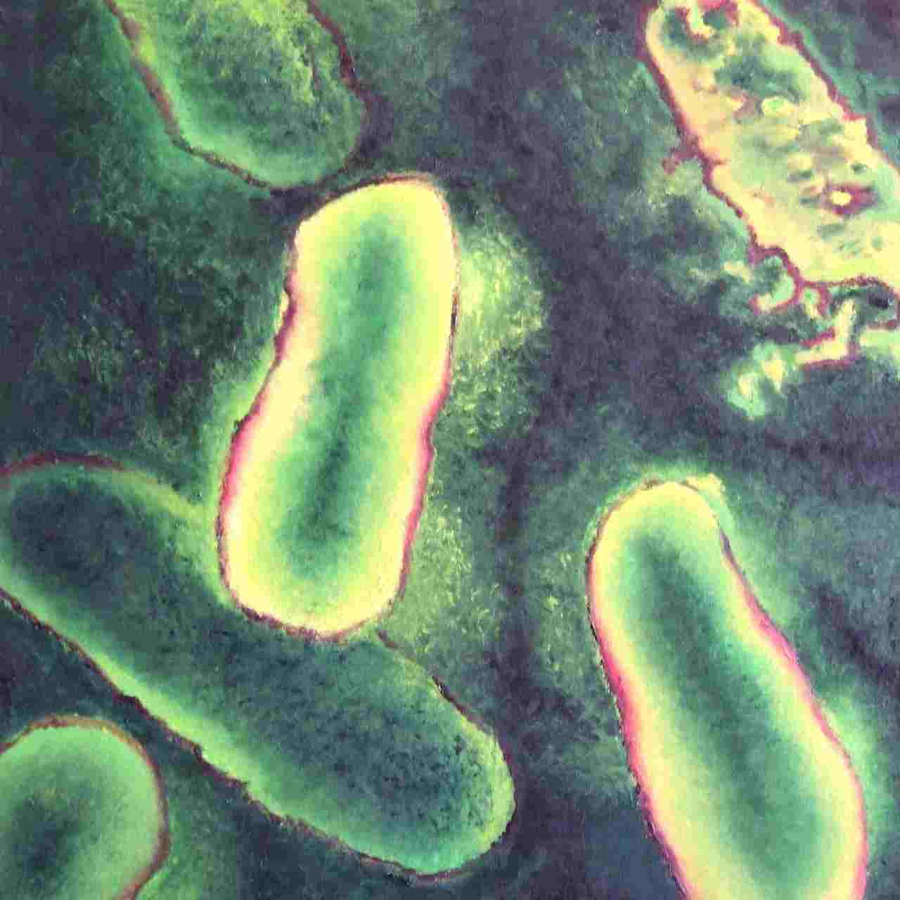 какие заболевания относят к болезням цивилизации ответ