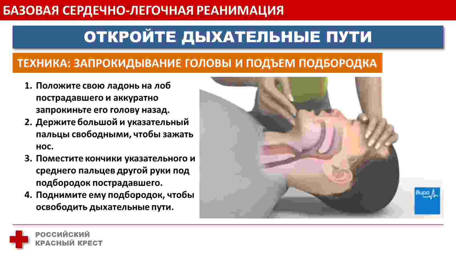 каким образом проводится сердечно легочная реанимация