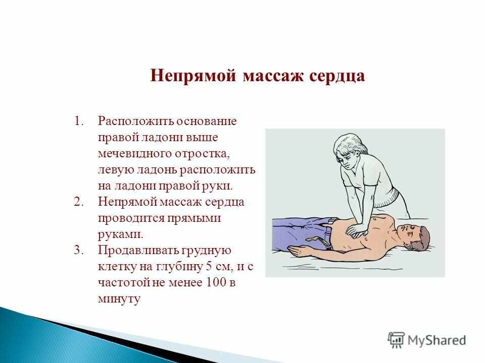 когда должен применяться непрямой массаж сердца