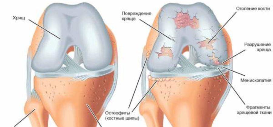 мазь для снятия отека и воспаления