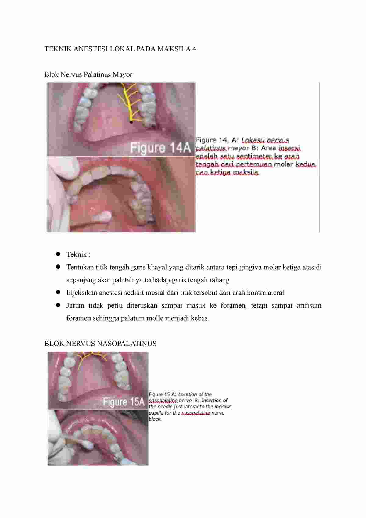 максилак капсулы инструкция по применению