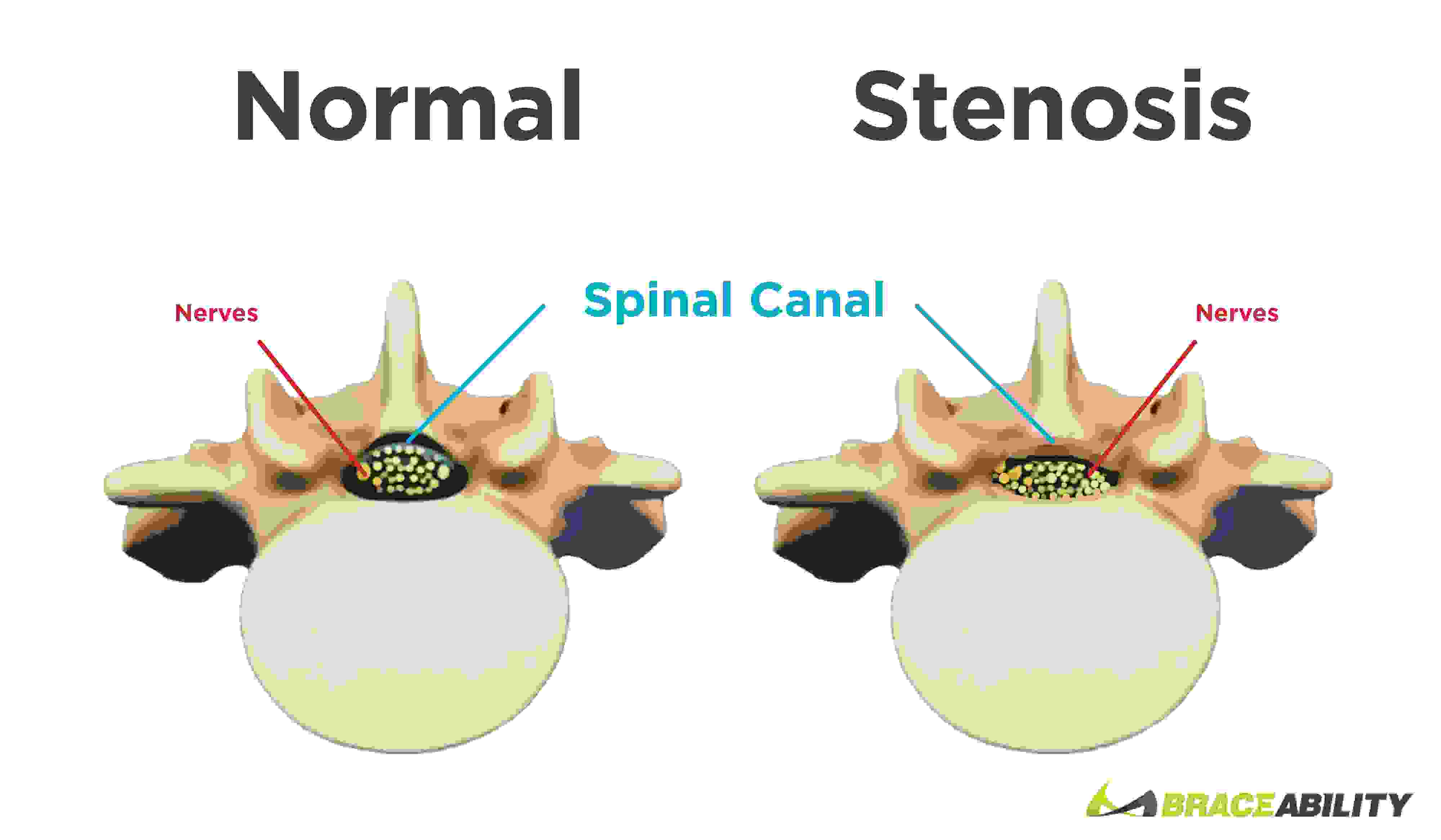 нарушение статики позвоночника что это