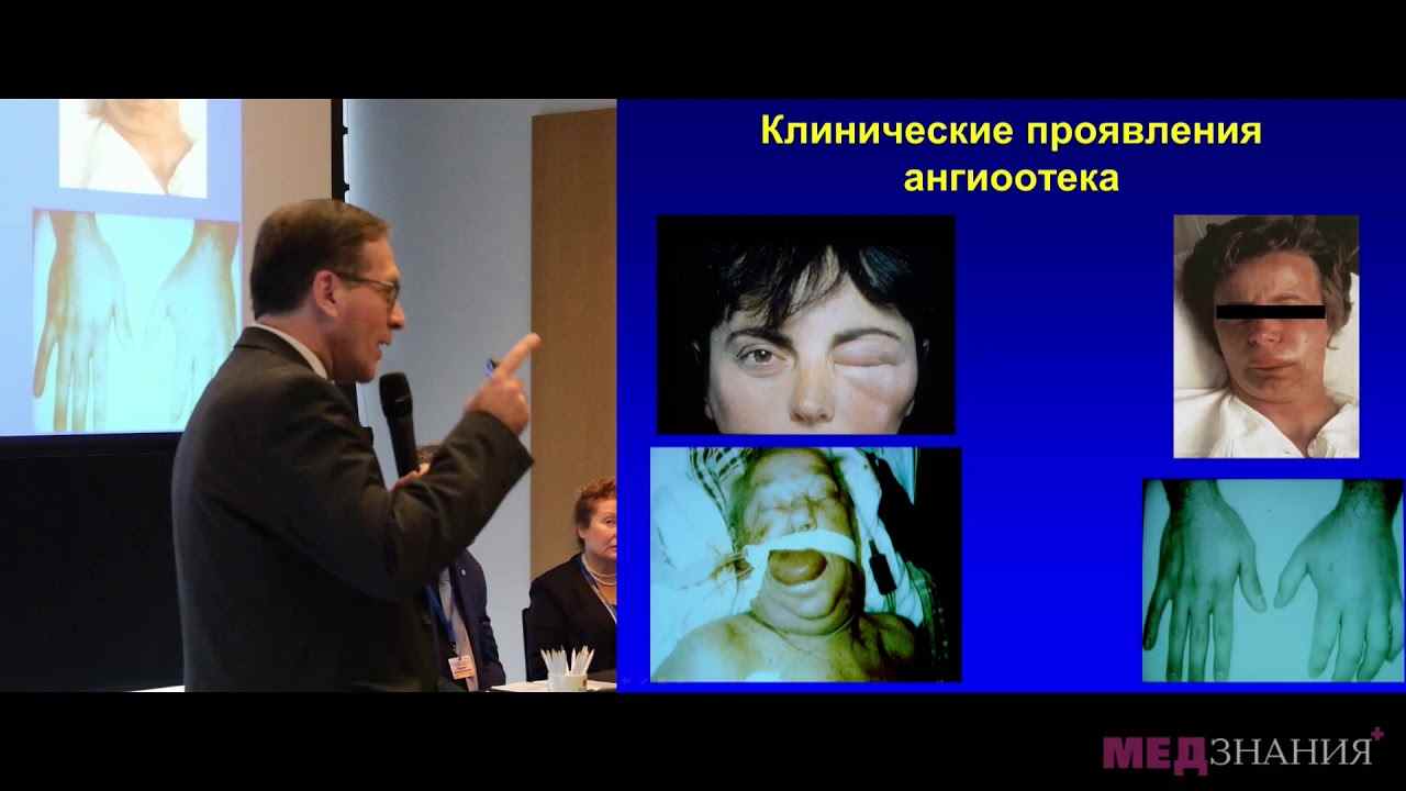 наследственный ангиоотек по утвержденным клиническим рекомендациям