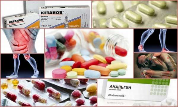 обезболивающие таблетки при болях в суставах