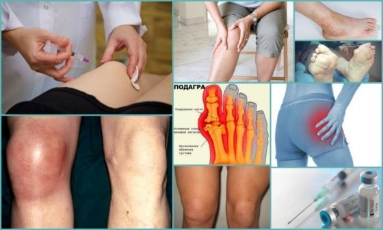 обезболивающие уколы при болях в суставах