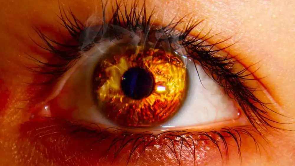 ожоги глаз по утвержденным клиническим рекомендациям 2024