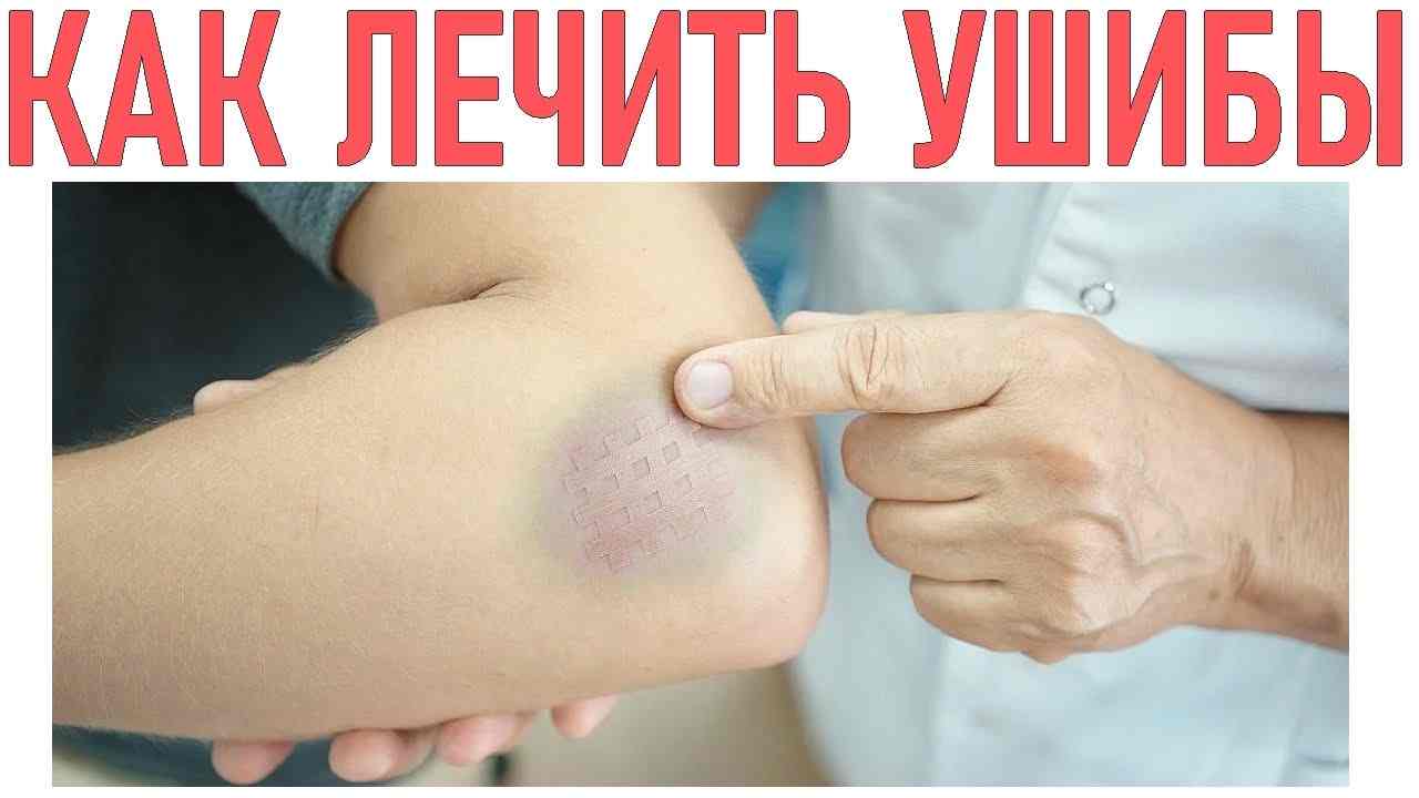 первая помощь при ушибах и вывихах