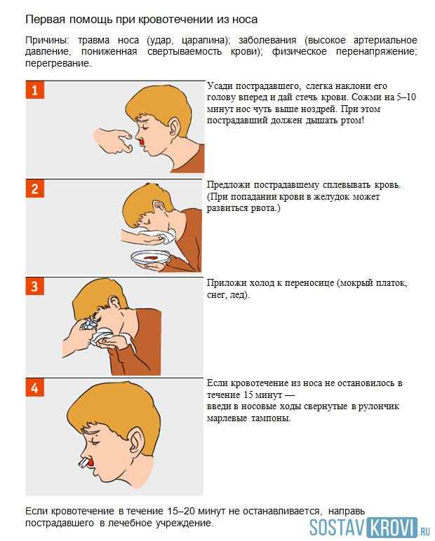 почему идет кровь из носа