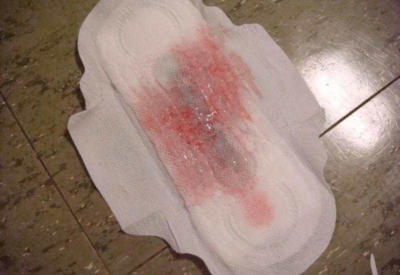 при беременности могут идти месячные