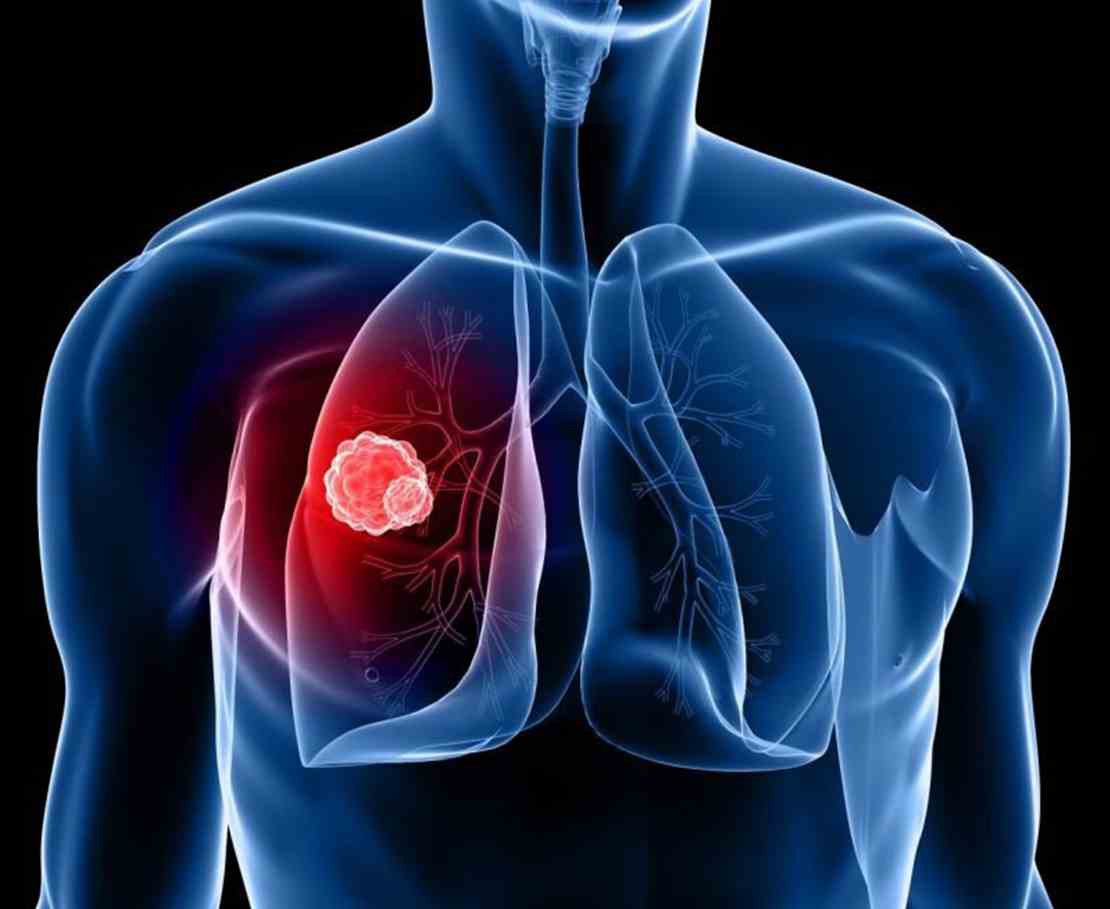 торакальный хирург это и что лечит