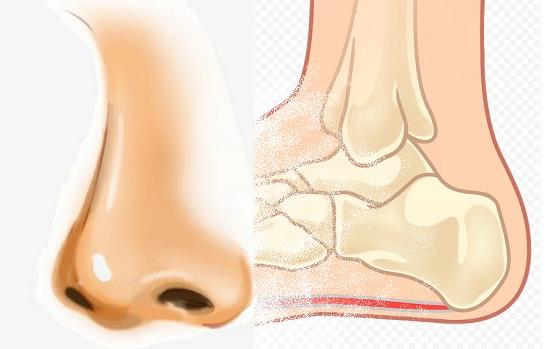 у кого за носом пятка