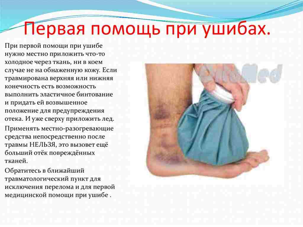 ушибы первая помощь при ушибах