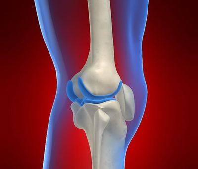 что такое мениск коленного сустава