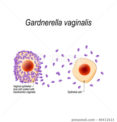 gardnerella vaginālis у женщин что это