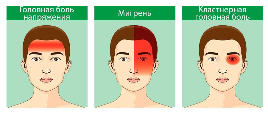 болит голова с одной стороны