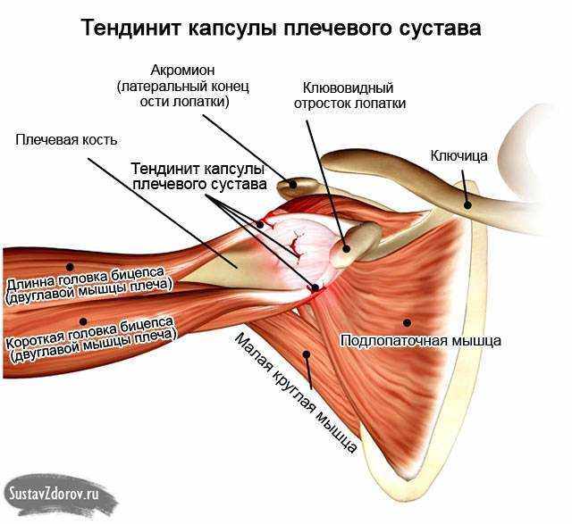 боль в плечевом суставе правой руки причины