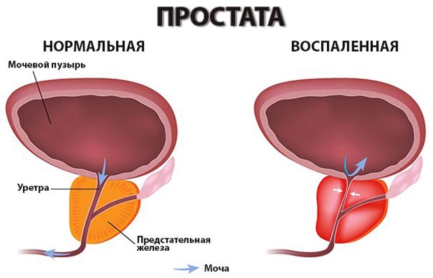 где находится простата у мужчин