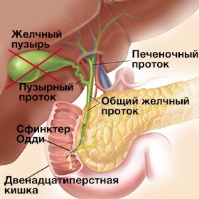 желчный пузырь где находится и как болит