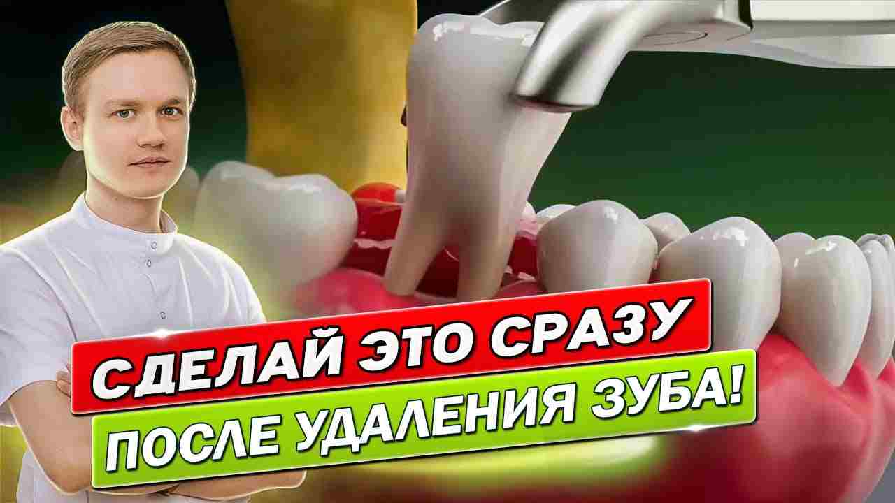 какие обезболивающие после удаления зуба