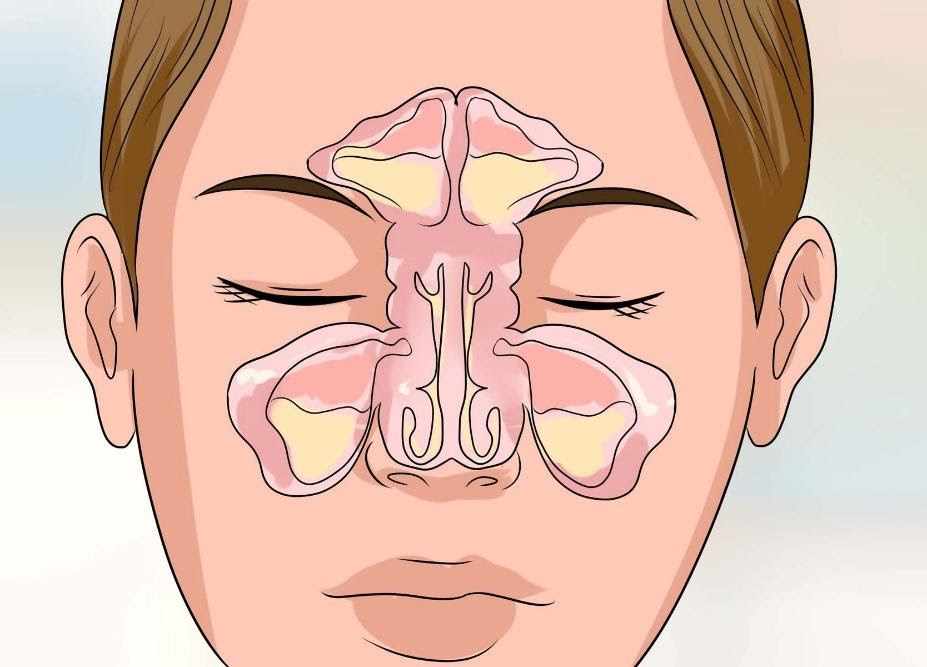 капли от гайморита эффективные и недорогие