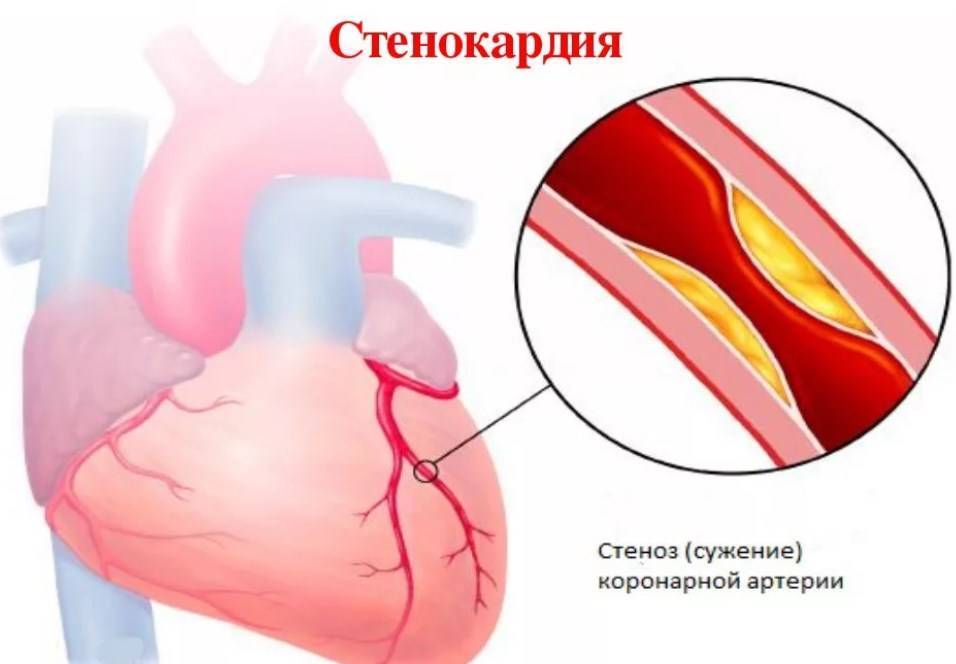 липримар инструкция по применению цена отзывы