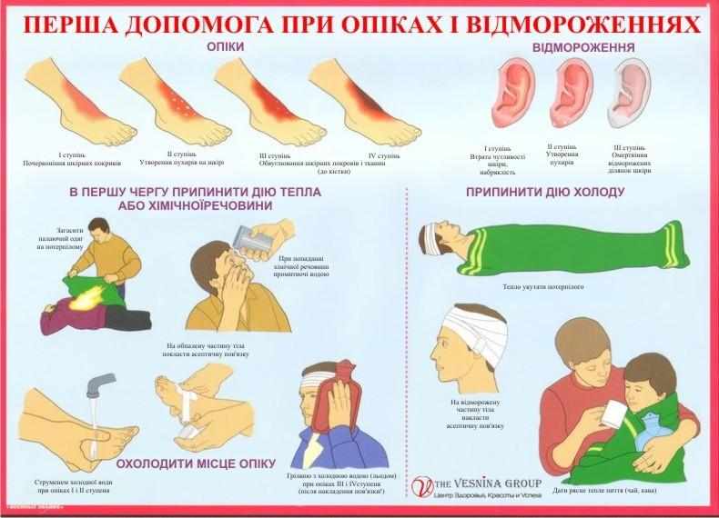 оказание первой помощи при ушибах