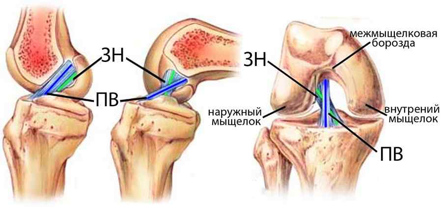 передняя крестообразная связка коленного сустава