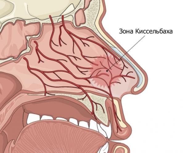 почему часто идет кровь из носа