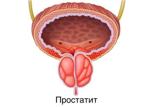 простата у мужчин что это