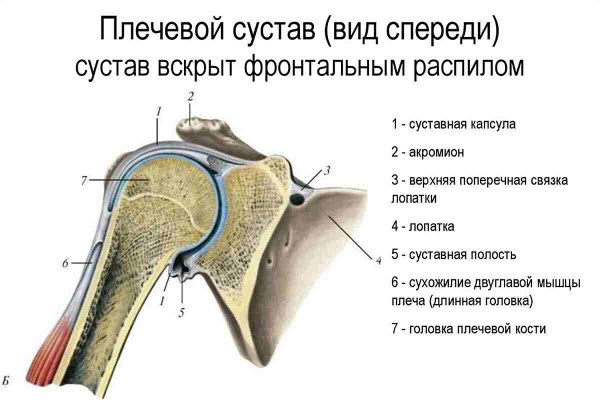 разрыв сухожилия надостной мышцы плечевого сустава