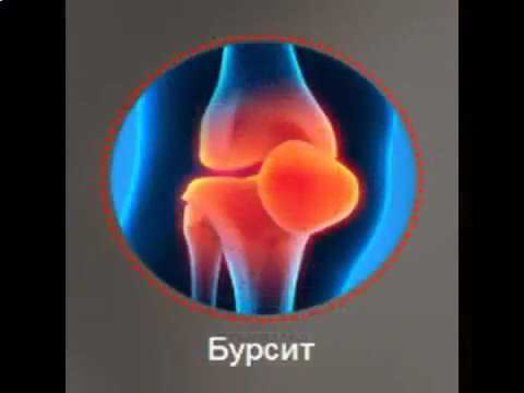 сильное обезболивающее при болях в суставах