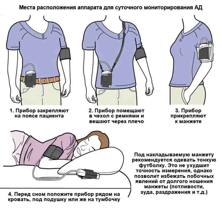 смад что это за обследование